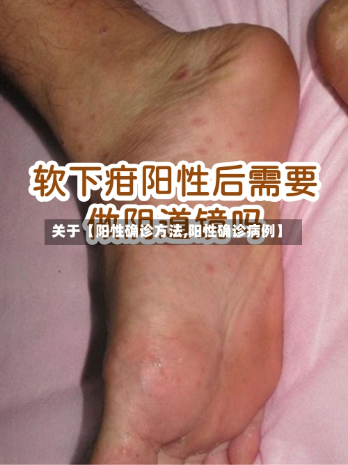 关于【阳性确诊方法,阳性确诊病例】